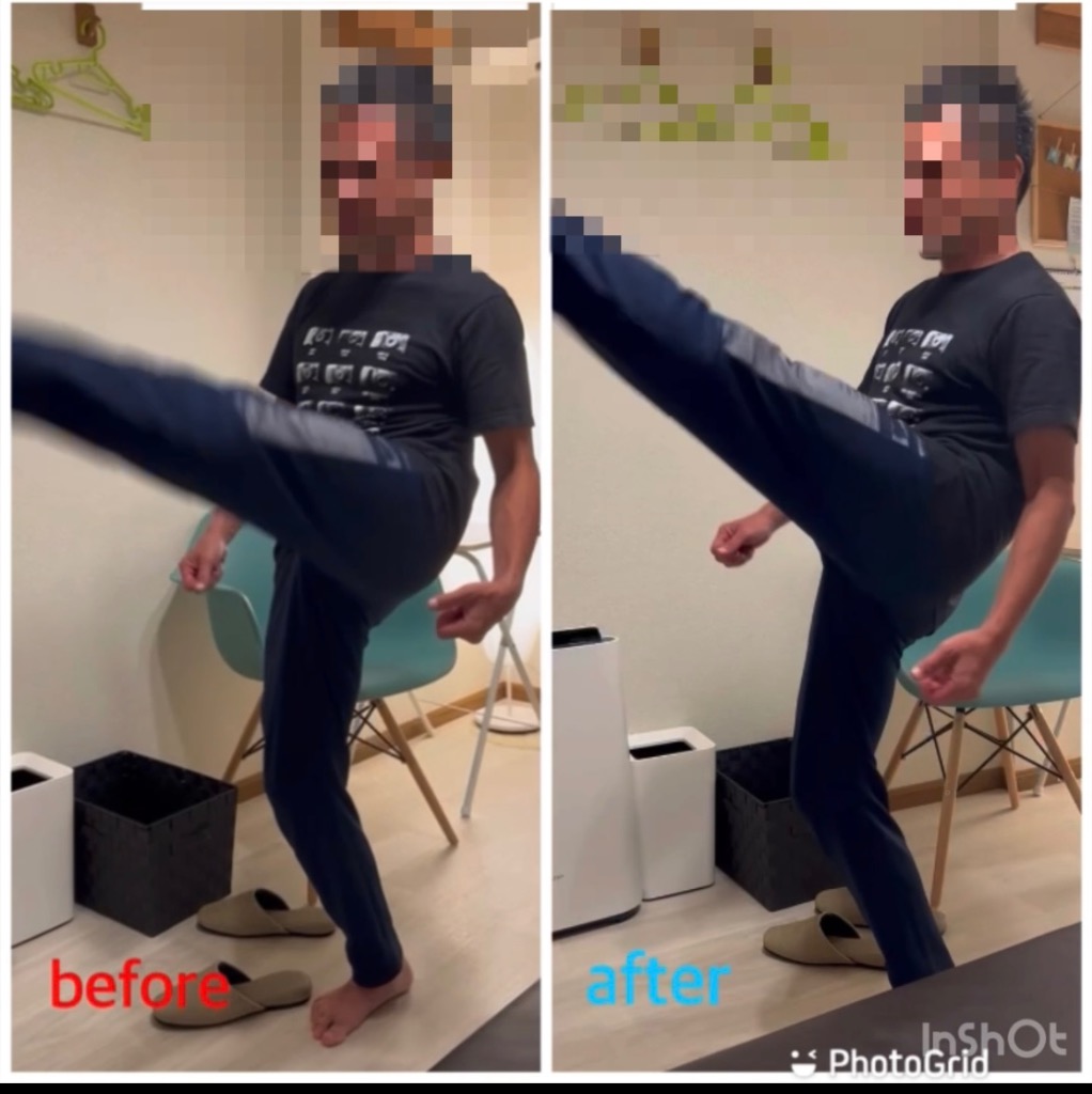 3ヶ月治らない肉離れも改善！